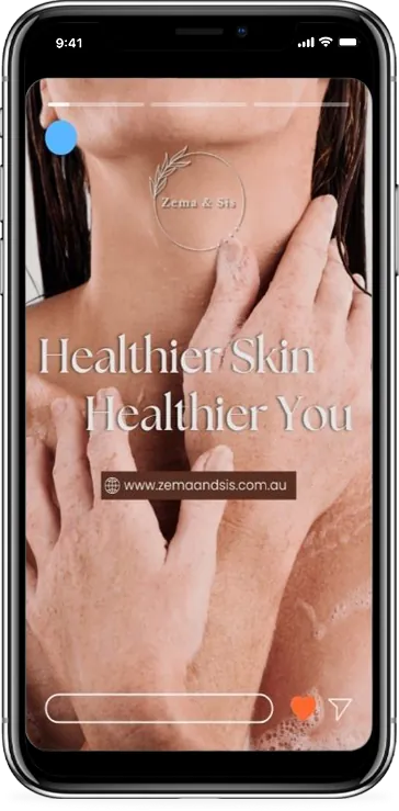 Zema and Sis Instagram story on healthier skin